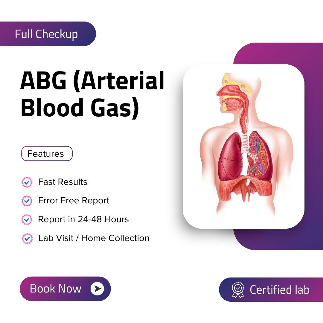 ABG (Arterial Blood Gas)