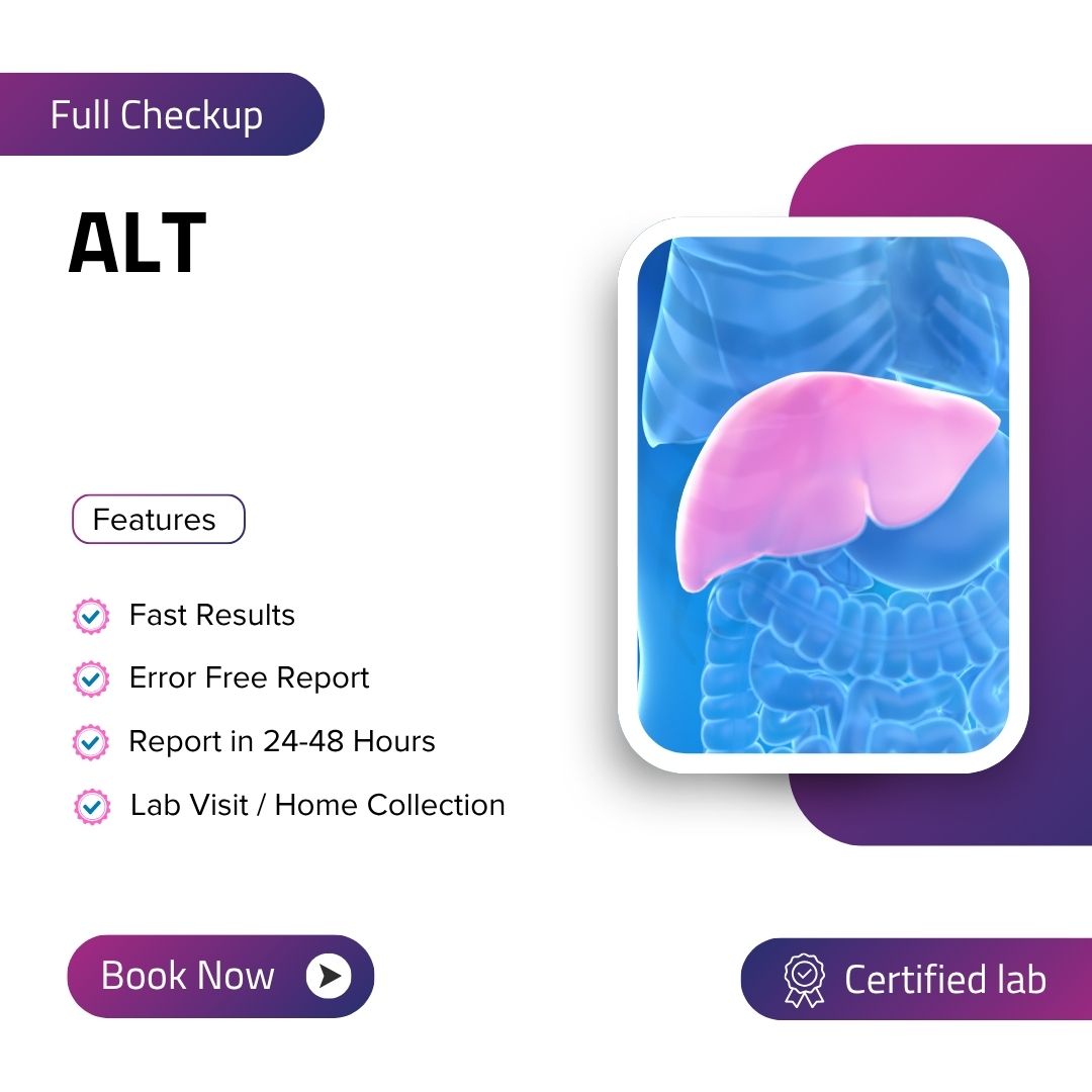 Care Test - ALT