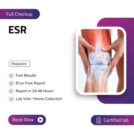 ESR (Erythrocyte Sedimentation Rate) - Arthritis