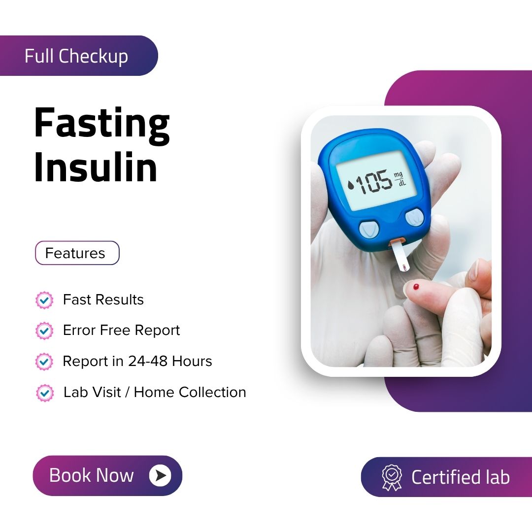 Care Test - Fasting Insulin