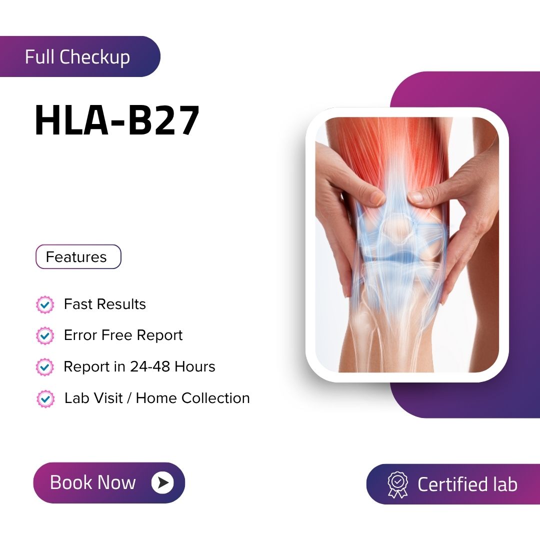 Care Test - HLA-B27
