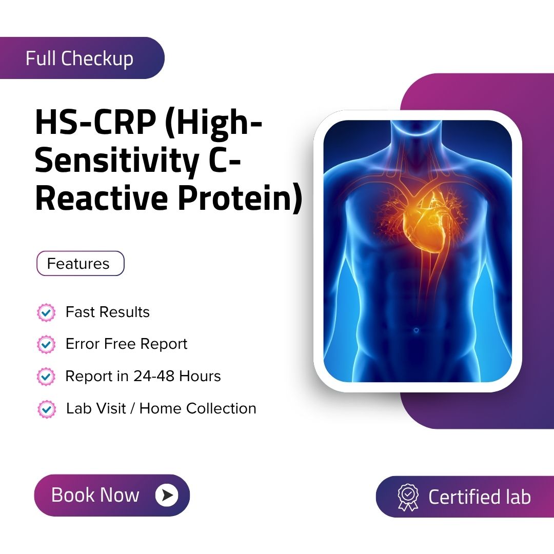 Care Test - HS-CRP (High-Sensitivity C-Reactive Protein)