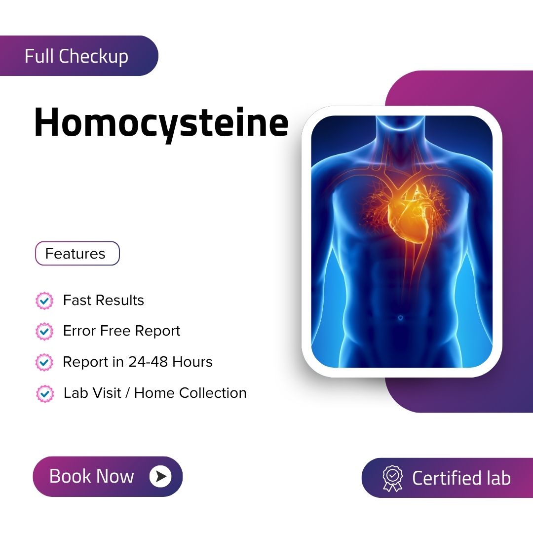 Care Test - Homocysteine