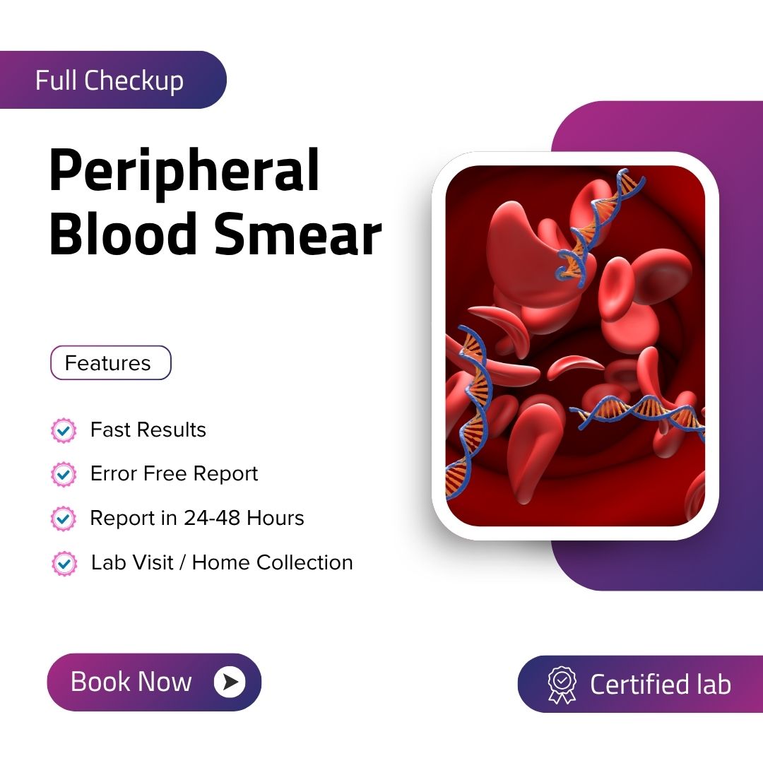 Care Test - Peripheral Blood Smear