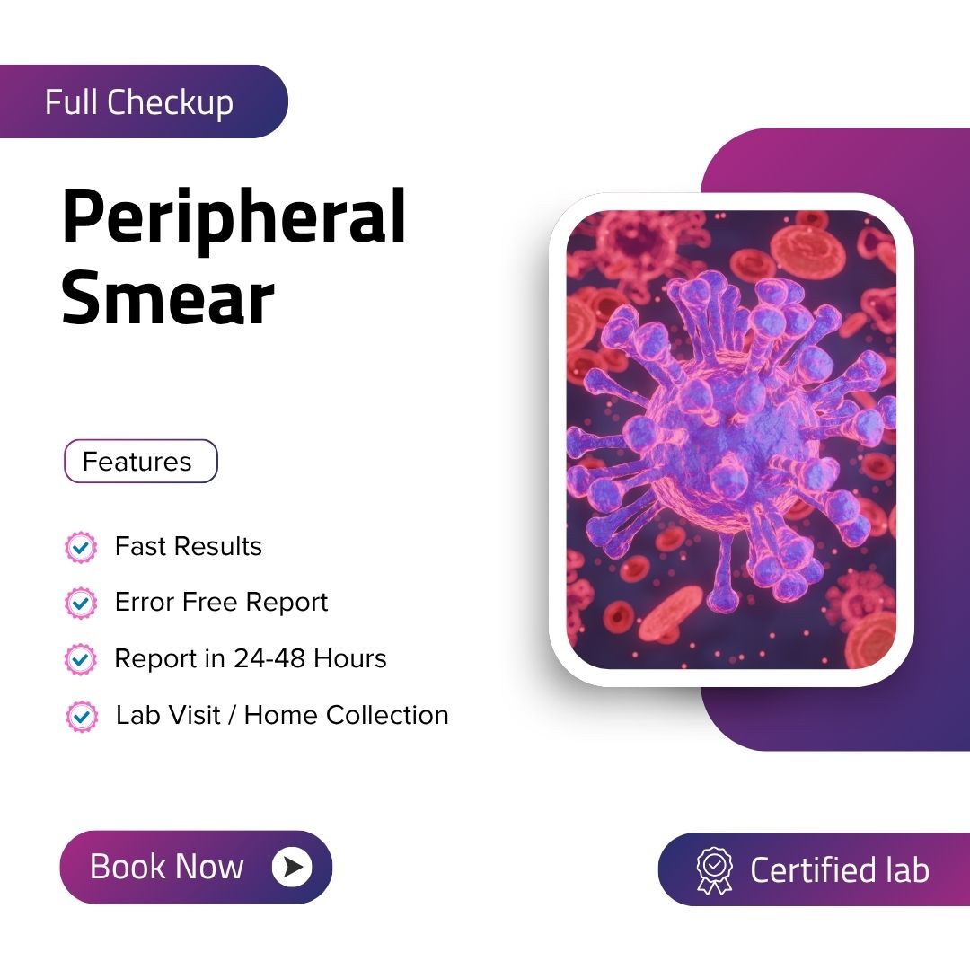Care Test - Peripheral Smear
