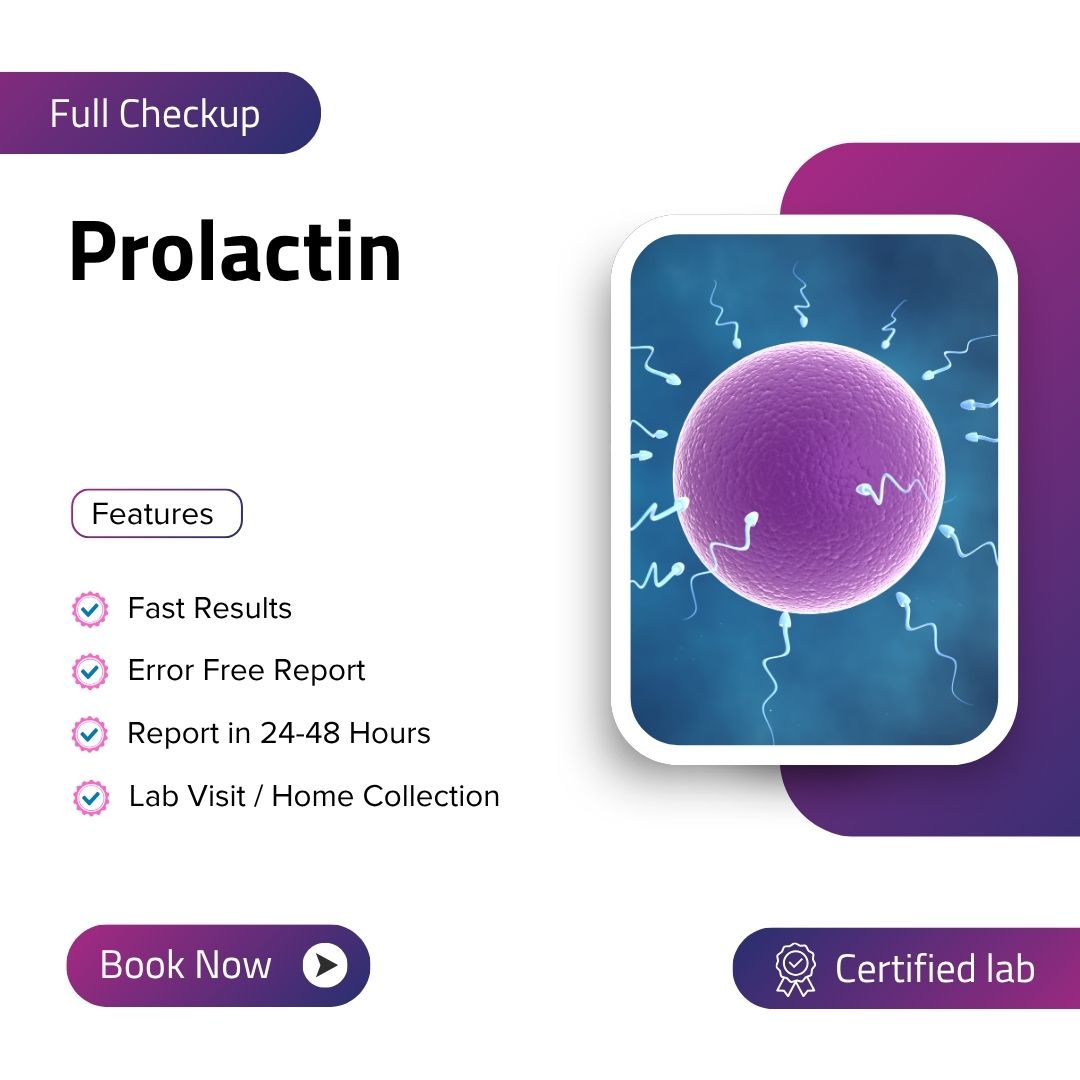 Care Test - Prolactin