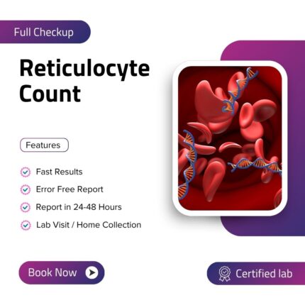 Reticulocyte Count