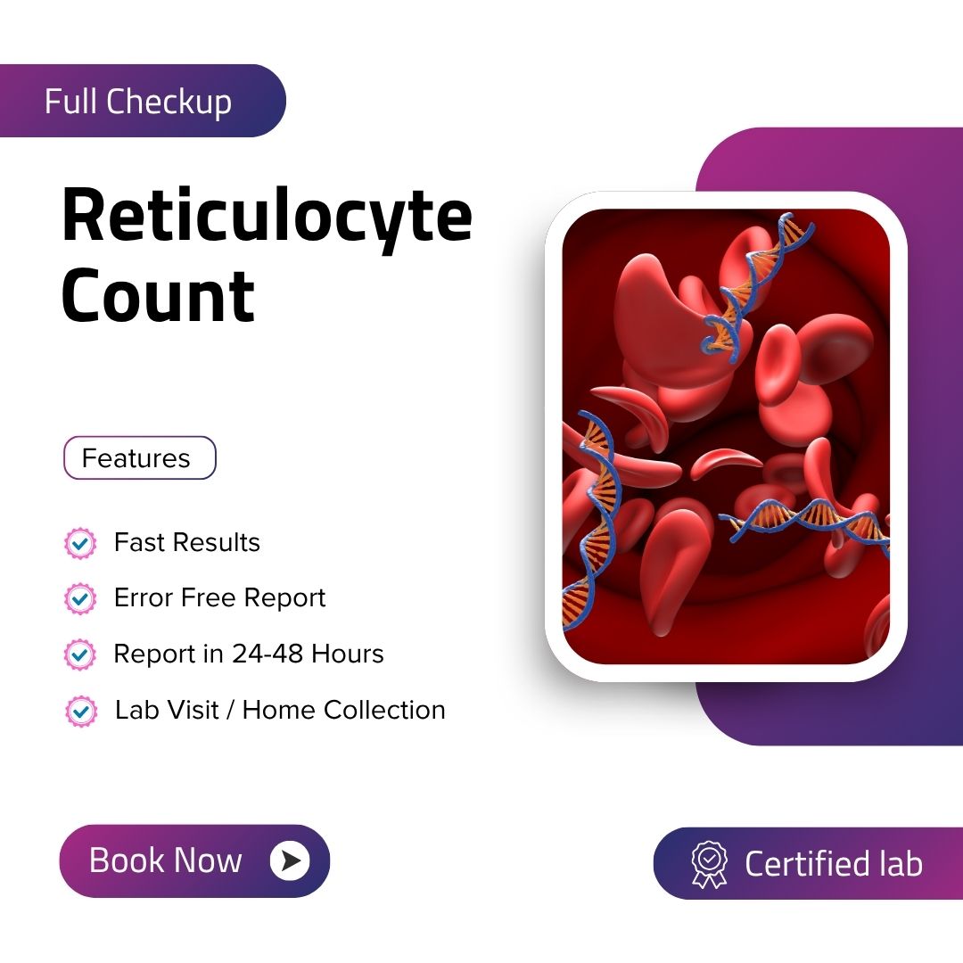 Care Test - Reticulocyte Count