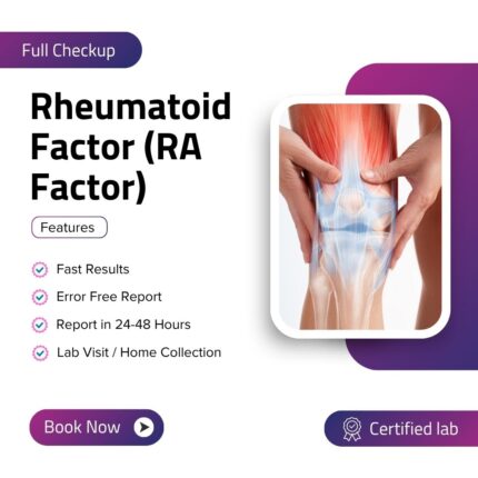 Rheumatoid Factor (RA Factor)