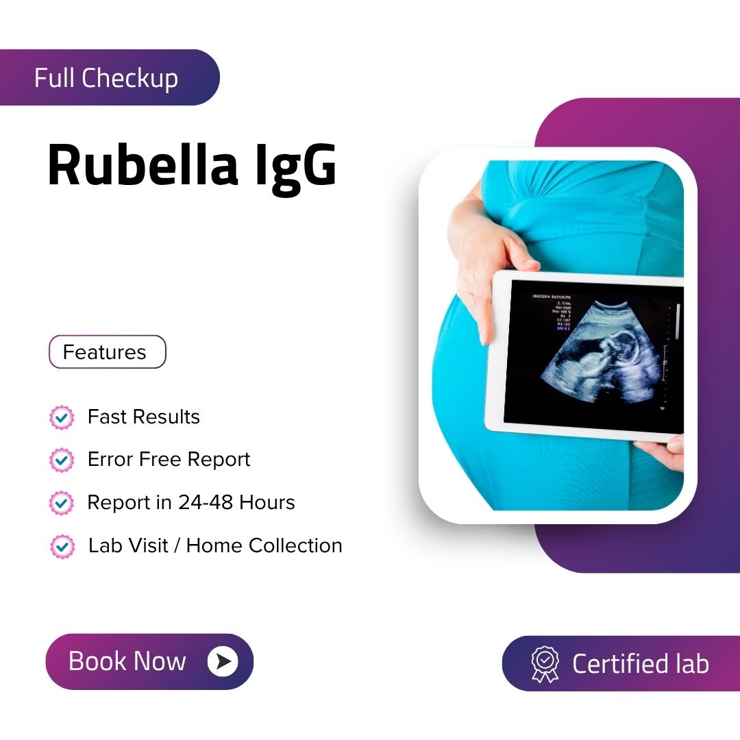 Care Test - Rubella IgG