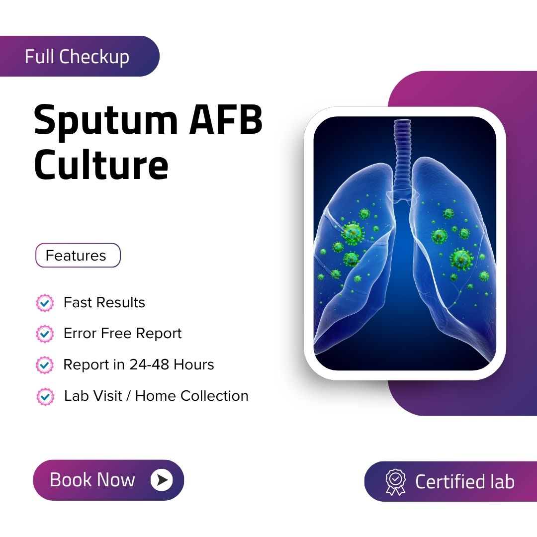 Care Test - Sputum AFB Culture