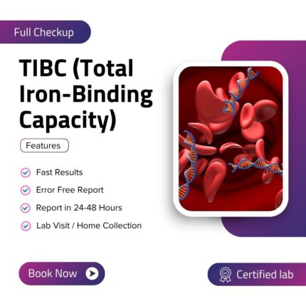 TIBC (Total Iron-Binding Capacity)