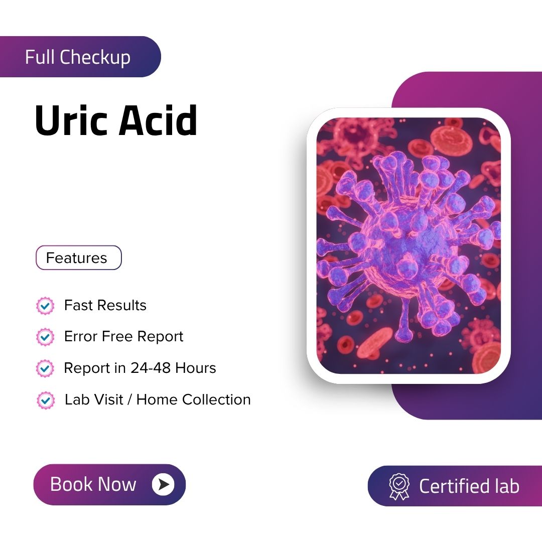 Care Test - Uric Acid