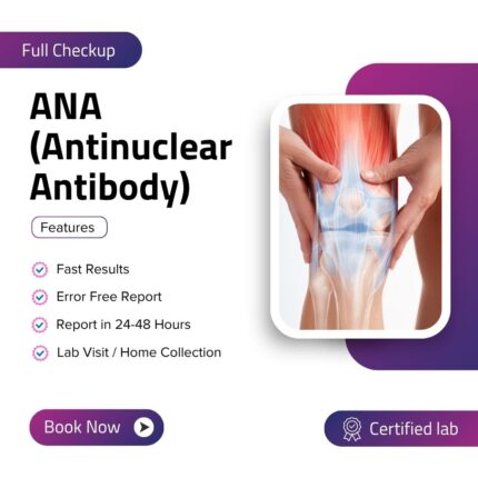 ANA (Antinuclear Antibody)