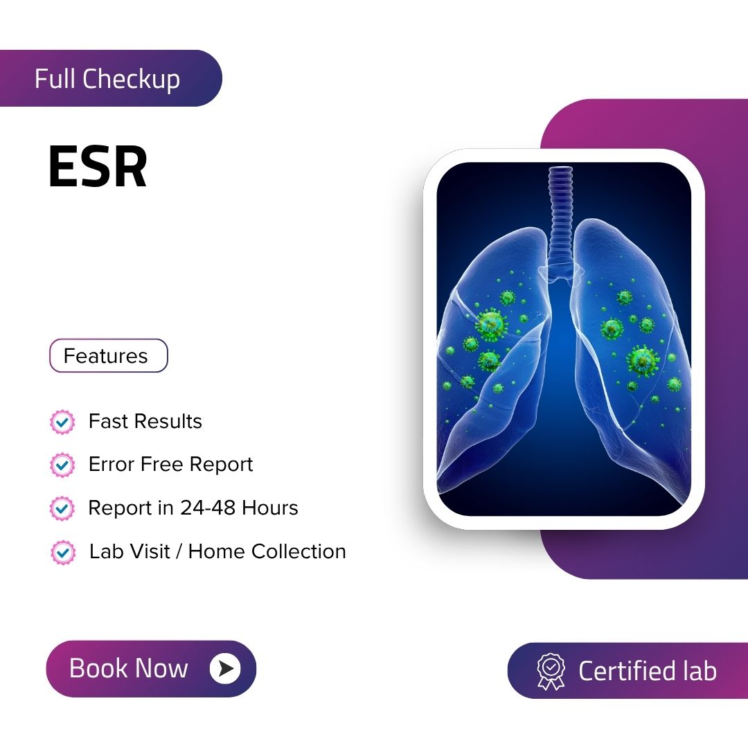 Care Test - esr
