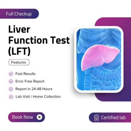 Liver Function Test (LFT)