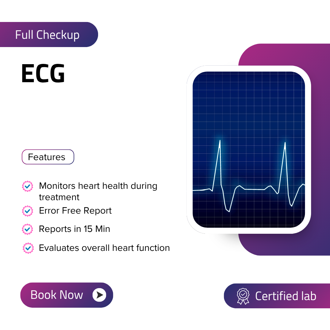 ECG