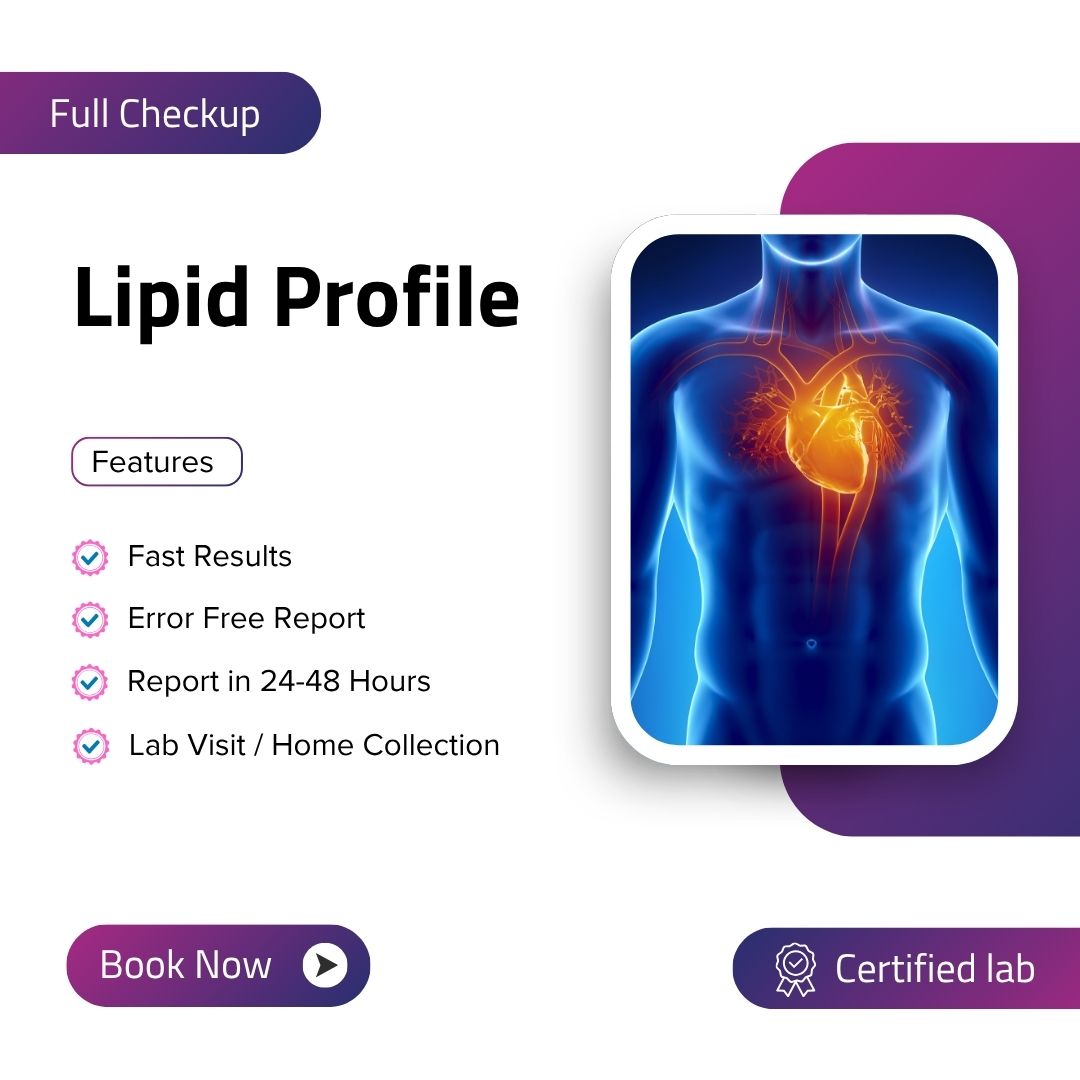 Lipid Profile