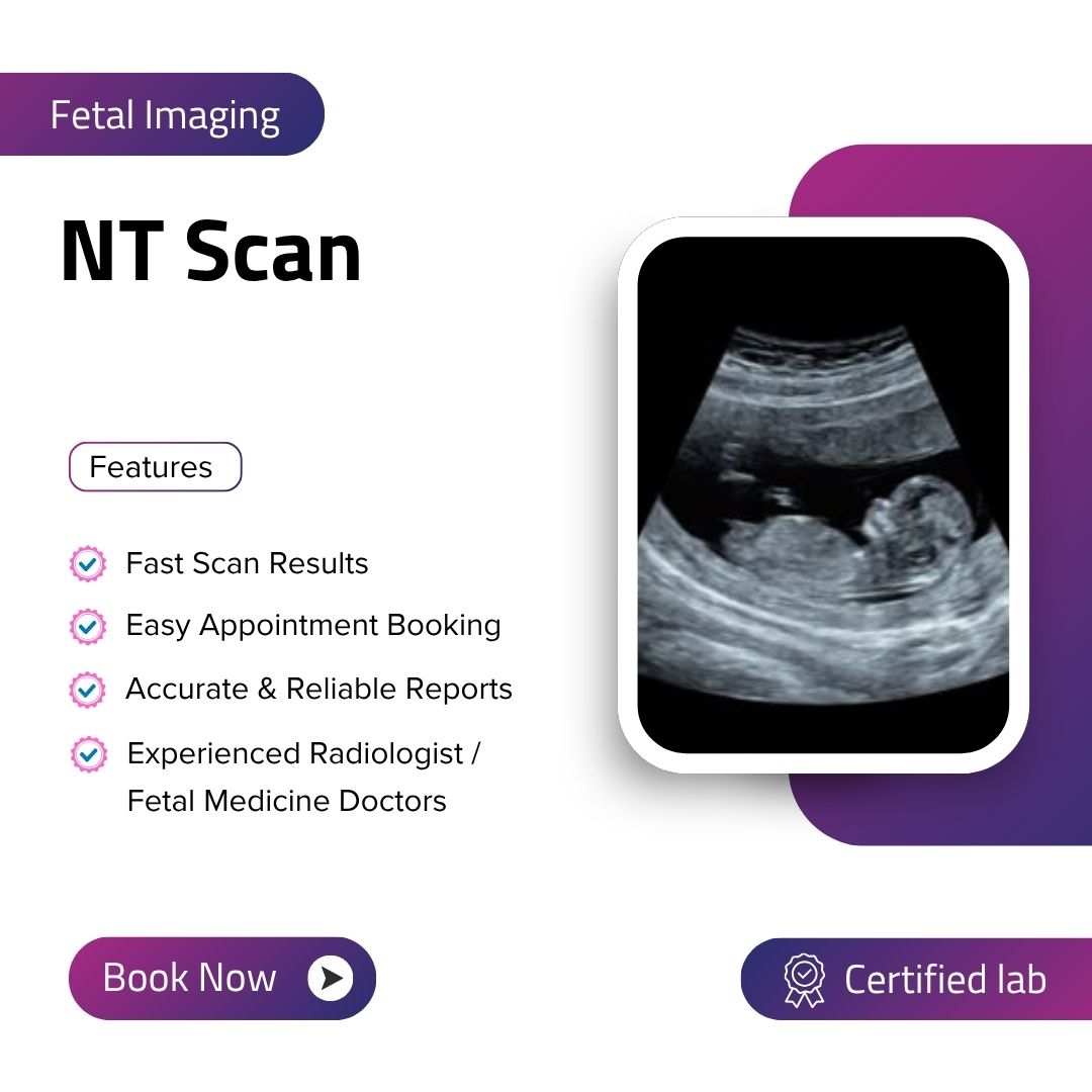 NT Scan