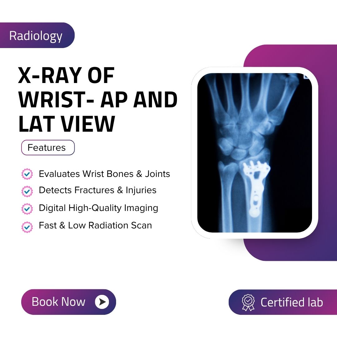 X-RAY OF WRIST- AP AND LAT VIEW