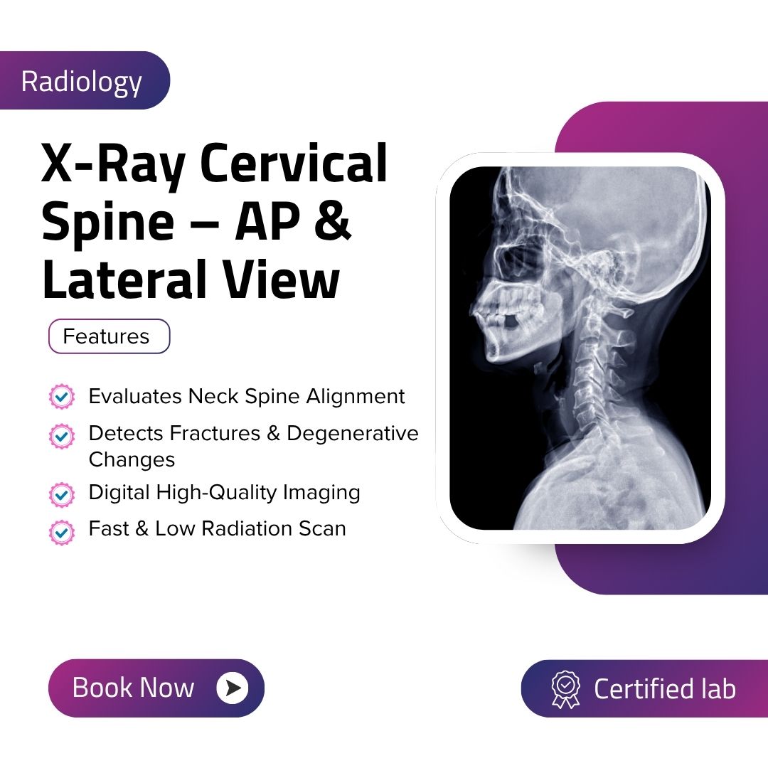 X-Ray Cervical Spine – AP & Lateral View