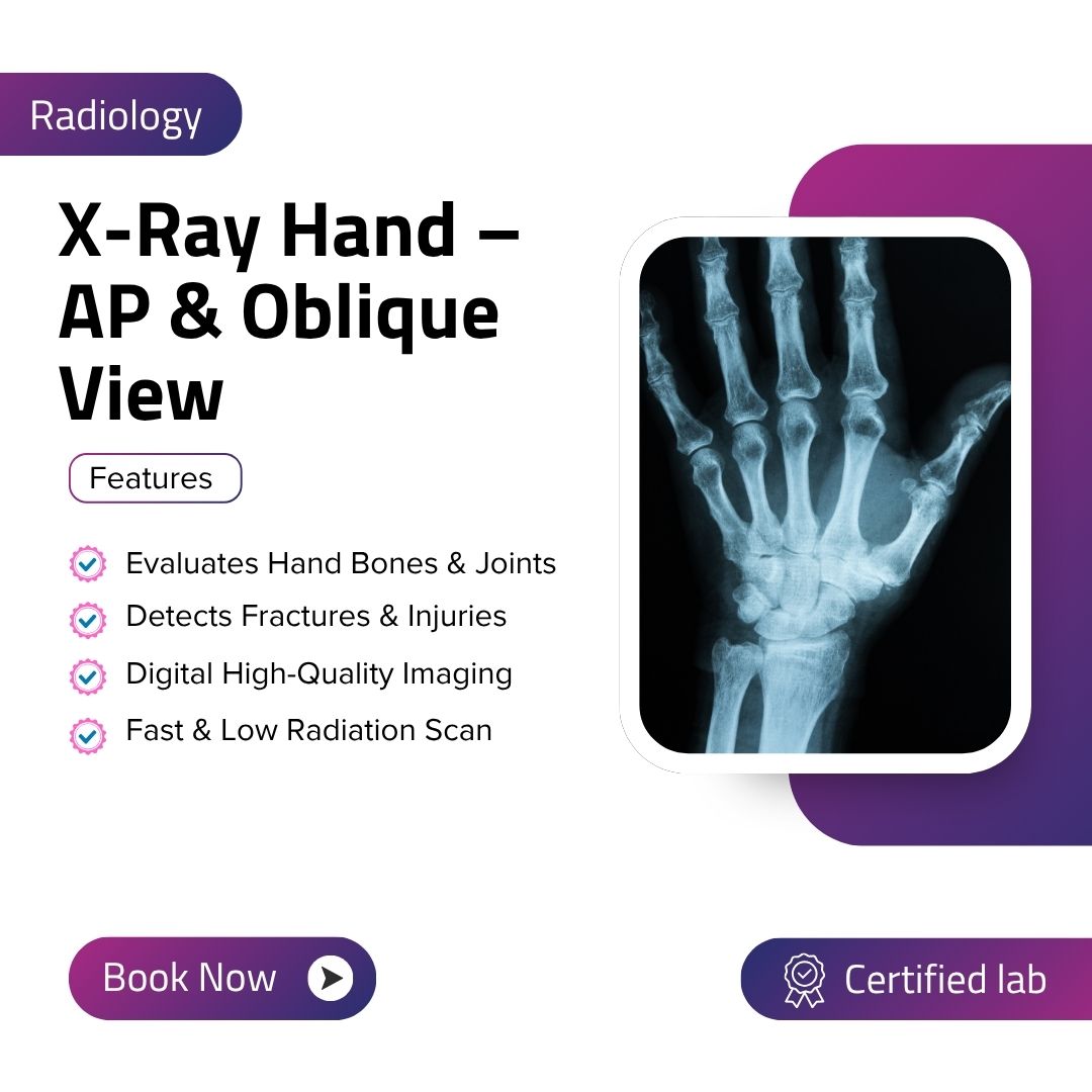 X-Ray Hand – AP & Oblique View