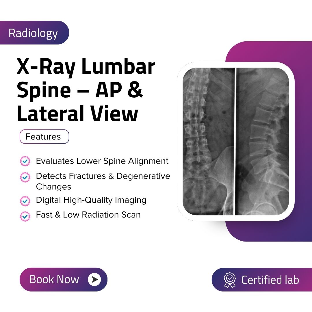 X-Ray Lumbar Spine – AP & Lateral View