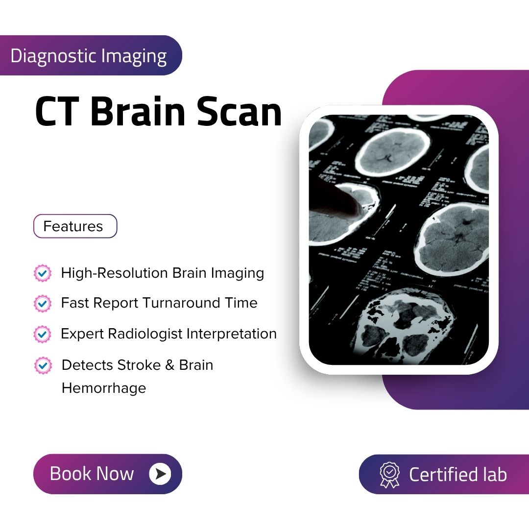 ct brain