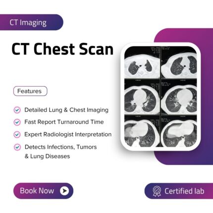 CT Chest Scan