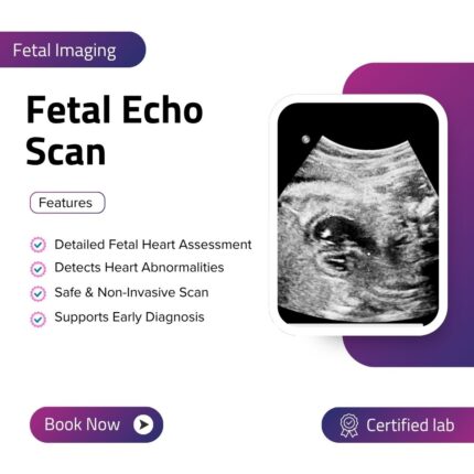 Fetal Echo Scan