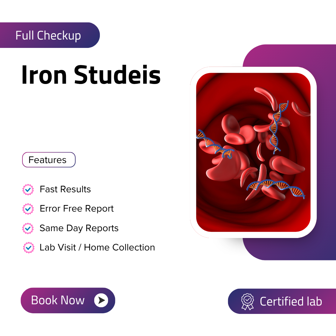 Iron Studeis